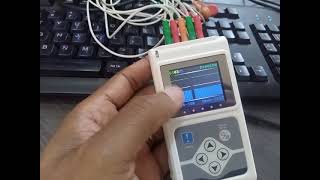 Holter ECG CONTEC TLC9803  mise en place et arrêt [upl. by Engracia]