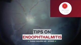 Tips on Endophthalmitis [upl. by Thanasi]