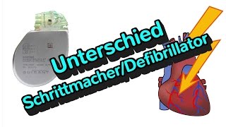 Was ist der Unterschied zwischen einem Defibrillator und einem Schrittmacher [upl. by Rennane]