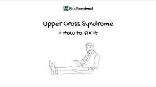 Upper Cross Syndrome amp How to Fix It [upl. by Eceinahs]