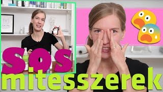 Mitesszer ellen  top tippek otthonra [upl. by Hahsi870]