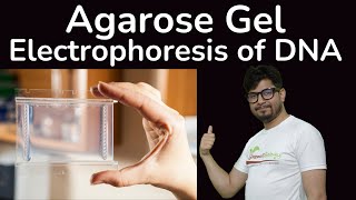 Agarose gel electrophoresis of DNA  agarose gel electrophoresis principle and procedure explained [upl. by Christensen604]