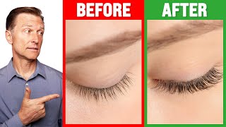 How to Grow Long Thick Eyelashes QUICKLY  Dr Berg [upl. by Conall]