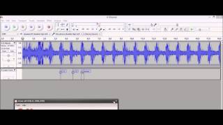 Heart and breath sounds records with homemade digital stethoscope [upl. by Neerom383]