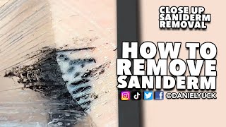 How To Remove Saniderm [upl. by Semela]