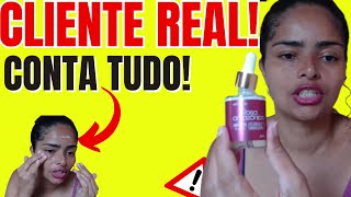 🛑😰ROSA AMAZÔNICA FUNCIONA ❌AVISO URGENTE❌ Rosa Amazonica Serum RESULTADOS Rosa Amazônica Preço [upl. by Alameda]