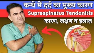 How to RELIEVE SUPRASPINATUS TENDONITIS  SHOULDER PAIN RELIEF EXERCISES [upl. by Malanie]