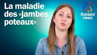 Atteinte de lipoedème ou maladie des jambes poteaux Manon est médecin et témoigne [upl. by Reinaldo119]