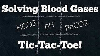 Acid Base Arterial Blood Gas ABG Interpretation Made Easy w TicTacToe Quick amp EZ Episode 13 [upl. by Einnaffit967]