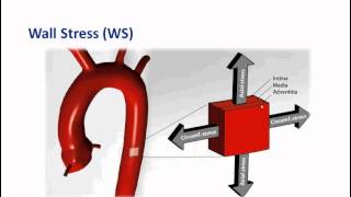 Biomechanical AAA Risk Assessment Part 3  Basic introduction to vascular biomechanics and BMRRA [upl. by Willi]