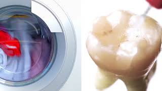 SmartLite Pro EndoActivator™ Washing Machine Comparison [upl. by Amek]