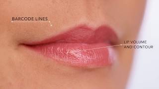 Fillerina Specific Zones with 3D Collagen [upl. by Marlyn14]