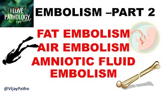 EMBOLISM Part 2 Fat Air amp Amniotic fluid embolism [upl. by Atiuqal]