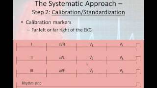 12 Lead Interpretation Part 2 The 6 Step 12Lead Interpretation Process [upl. by Bazil]