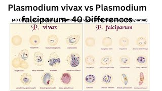 Plasmodium vivax vs Plasmodium falciparum 40 Differences [upl. by Neerol]