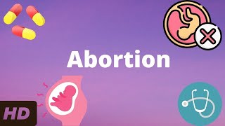 Abortion Everything You Need To Know [upl. by Utimer681]