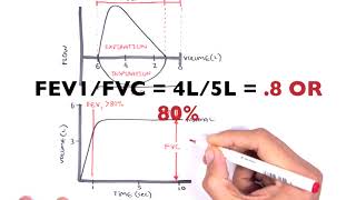 Understanding Spirometry  Normal Obstructive vs Restrictive [upl. by Ettedanreb658]