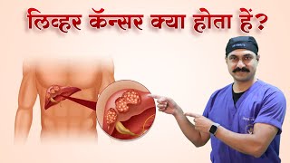 क्या Liver Cancer को ठीक कर सकते है Liver Cancer Treatment  DrBipin Vibhute  Hindi [upl. by Buchanan]