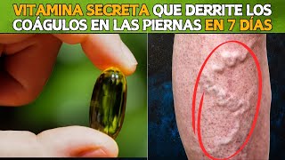 💊🚨 La VITAMINA SECRETA Que Disuelve los Coágulos de Sangre en Tus Piernas 🦵💥 [upl. by Oliver]