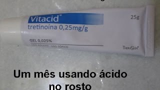 Como estou usando ácido tretinoína  Vitacid 1 [upl. by Thorin596]