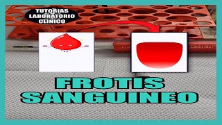 🩸¿Como Hacer un FROTIS SANGUÍNEO Extendido de Sangre Periférica 🔬Tutorial Laboratorio Clínico [upl. by Delgado484]