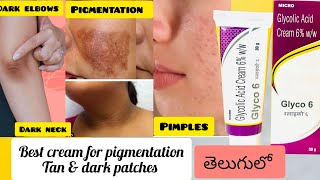 GLYCO 6 Cream review in telugu How to use Glycolic acidGlycolic acid cream [upl. by Anelrahs]