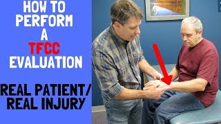 How to Perform a TFCC EvaluationReal patient real injury [upl. by Keir]