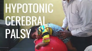 Hypotonic Cerebral Palsy Home Tips amp Physiotherapy [upl. by Elladine]