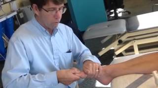 Hallux Limitus Evaluation with Self Mobilization [upl. by Inglebert]