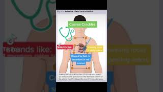 Chest Auscultation Identifying common BreathLung Sounds [upl. by Skurnik]