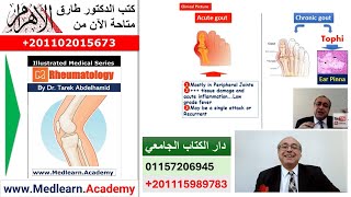 Gout Gouty arthritis cme internalmedicine usmle medicalschool medical محاضراتباطنة [upl. by Janenna]