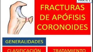 fracturas de apofisis coronoides parte 1 [upl. by Theone]