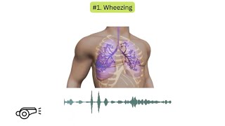 Abnormal lung sounds in COPD [upl. by Livingston]