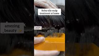 dandruff or itchy oily scalp treatment at home dandruffitchyoilyscalp treatmenthairmaskoilyscalp [upl. by Karolina634]