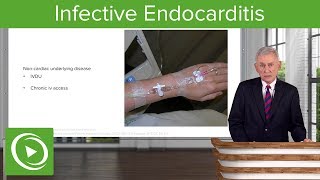 Infective Endocarditis IE Definition amp Epidemiology– Infectious Diseases  Lecturio [upl. by Avat]