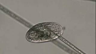 ciliate ingesting cyanobacteriam1v [upl. by Guillemette992]