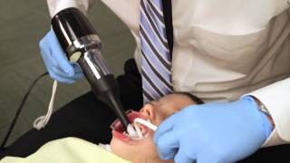 Rapid Palatal Expander Procedure Explained [upl. by Enirok]