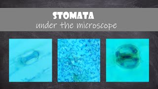 Stomata under the Microscope  Plant Biology [upl. by Ronnie]