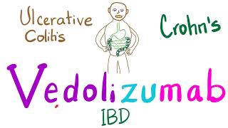 Management of Inflammatory Bowel Disease IBD Crohns and Ulcerative Colitis [upl. by Hsepid]