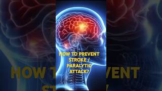 HOW TO PREVENT STROKE OR PARALYTIC ATTACK stroke paralysisdiabetesdrvijaychile [upl. by Clein]