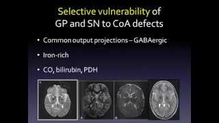 How defects in pantothenate metabolism cause neurodegeneration [upl. by Faust]