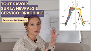 NÉVRALGIE CERVICOBRACHIALE  cause et symptômes pour mieux agir ensuite [upl. by Daria]