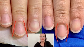 How I shaped these nails from fanning out to oval Nail technician explains [upl. by Nart]