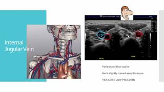 Upper Extremity Venous tutorial1 [upl. by Idnor705]