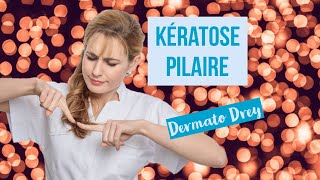 Kératose pilaire  boutons peau granuleuse poils incarnés comment se soigner  DermatoDrey [upl. by Kort416]