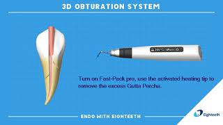 How to Use Eighteeth Obturation System FastPack FastFill Continuous Wave Compaction WVC [upl. by Zinn]