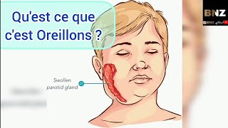 Oreillons  définition  Transmission  Complication  Symptômes et Traitement 😀 [upl. by Armstrong]