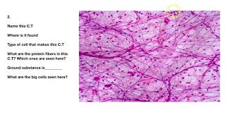 Connective Tissue Quiz and Review [upl. by Nevek]