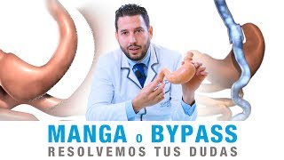 Diferencias entre Bypass Gástrico y Manga Gástrica  Clínicas Diego de León [upl. by Markos]