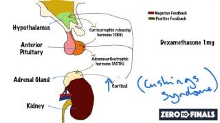 Understanding The Dexamethasone Suppression Test [upl. by Anirod851]